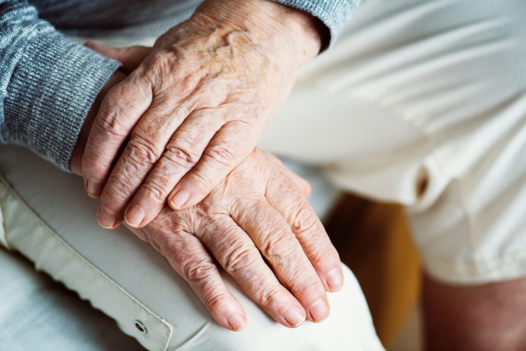 Aging hands